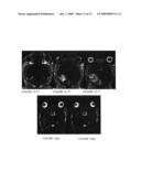 Systems and methods for opening of the blood-brain barrier of a subject using ultrasound diagram and image