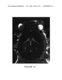 Systems and methods for opening of the blood-brain barrier of a subject using ultrasound diagram and image