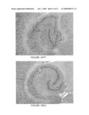 Systems and methods for opening of the blood-brain barrier of a subject using ultrasound diagram and image