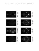 Systems and methods for opening of the blood-brain barrier of a subject using ultrasound diagram and image