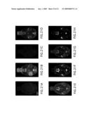 Systems and methods for opening of the blood-brain barrier of a subject using ultrasound diagram and image