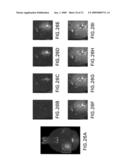 Systems and methods for opening of the blood-brain barrier of a subject using ultrasound diagram and image