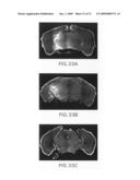 Systems and methods for opening of the blood-brain barrier of a subject using ultrasound diagram and image