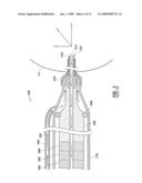 SYSTEM AND METHOD FOR CONTROLLING A TRANSVERSE PHACOEMULSIFICATION SYSTEM WITH A FOOTPEDAL diagram and image