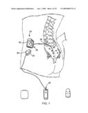 CONTROLLING TEMPERATURE DURING RECHARGE FOR TREATMENT OF CONDITION diagram and image