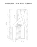 Optical Pyrometric Catheter for Tissue Temperature Monitoring During Cardiac Ablation diagram and image