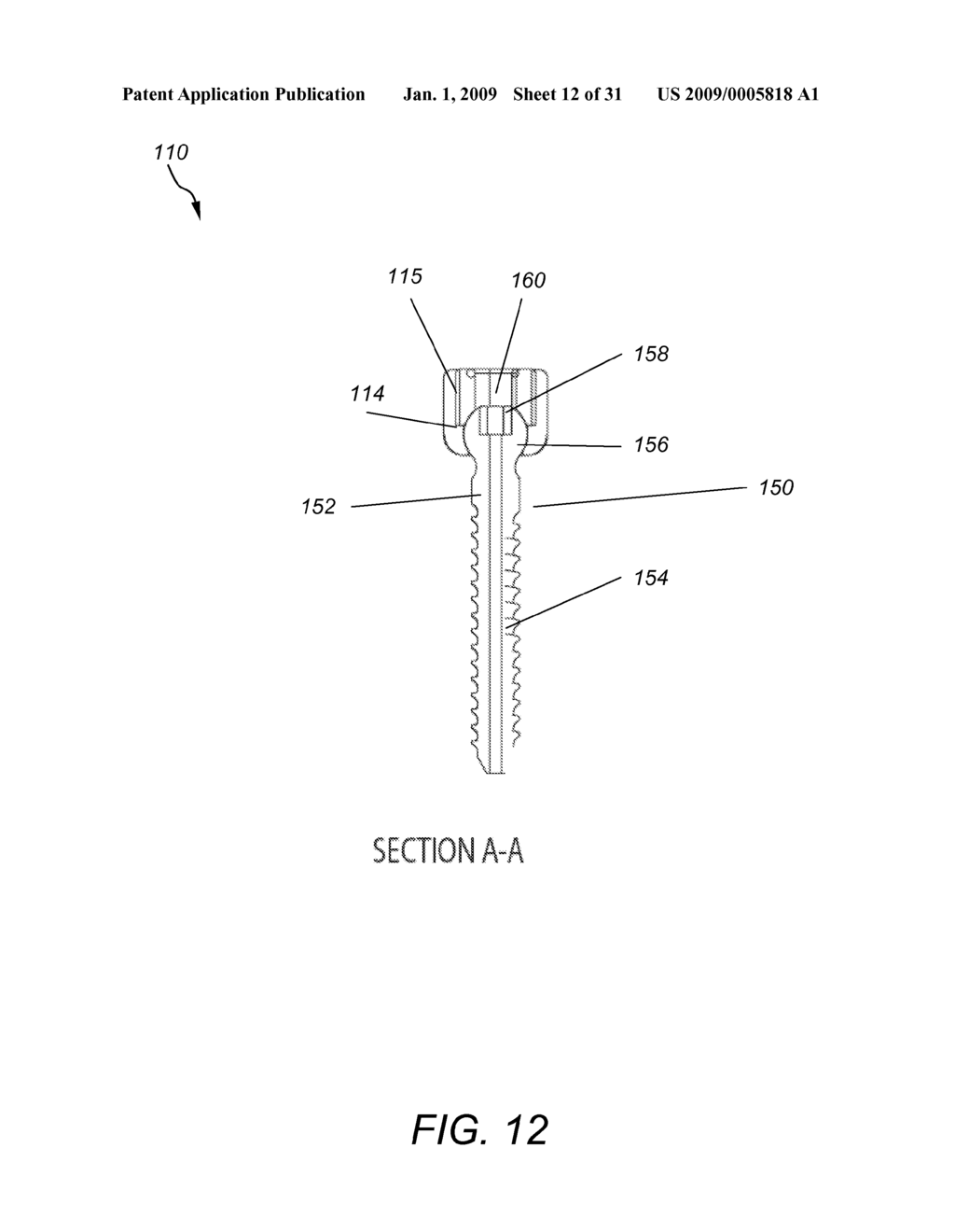 DYNAMIC FACET REPLACEMENT SYSTEM - diagram, schematic, and image 13