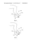 Deep vein thrombosis prevention diagram and image