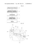 Cochlear Implant diagram and image