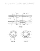 Methods and apparatuses for coating a lesion diagram and image