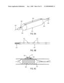 Methods and apparatuses for coating a lesion diagram and image