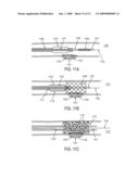 Methods and apparatuses for coating a lesion diagram and image