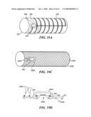 ENDOLUMINAL IMPLANT WITH THERAPEUTIC AND DIAGNOSTIC CAPABILITY diagram and image