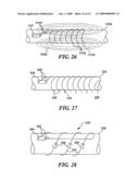 ENDOLUMINAL IMPLANT WITH THERAPEUTIC AND DIAGNOSTIC CAPABILITY diagram and image