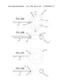 SUTURE-BASED ORTHOPEDIC JOINT DEVICES diagram and image
