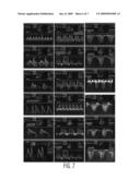 Method and system for detection of deformable structures in medical images diagram and image