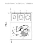 MEDICAL IMAGE PROCESSING APPARATUS AND MEDICAL IMAGE DIAGNOSIS APPARATUS diagram and image