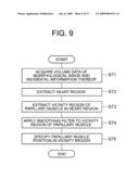 MEDICAL IMAGE PROCESSING APPARATUS AND MEDICAL IMAGE DIAGNOSIS APPARATUS diagram and image