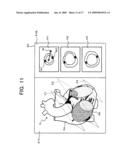 MEDICAL IMAGE PROCESSING APPARATUS AND MEDICAL IMAGE DIAGNOSIS APPARATUS diagram and image