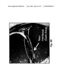 METHODS AND COMPOSITIONS FOR OPTIMIZED EXPANSION AND IMPLANTATION OF MESENCHYMAL STEM CELLS diagram and image