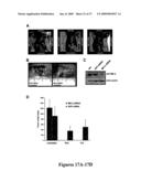 Mapkap kinase-2 as a specific target for blocking proliferation of P53-defective cells diagram and image