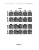 Mapkap kinase-2 as a specific target for blocking proliferation of P53-defective cells diagram and image