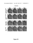 Mapkap kinase-2 as a specific target for blocking proliferation of P53-defective cells diagram and image