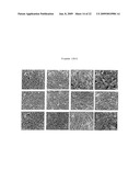 STEROID LIPID-MODIFIED POLYURETHANE AS AN IMPLANTABLE BIOMATERIAL, THE PREPARATION AND USES THEREOF diagram and image