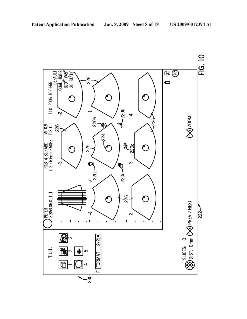 USER INTERFACE FOR ULTRASOUND SYSTEM - diagram, schematic, and image 09