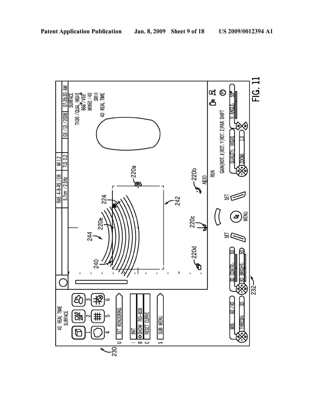 USER INTERFACE FOR ULTRASOUND SYSTEM - diagram, schematic, and image 10