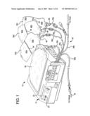 DIALYSIS FLUID MEASUREMENT SYSTEMS USING CONDUCTIVE CONTACTS diagram and image