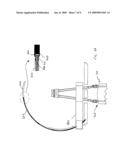 SPINAL FIXATION DEVICES AND METHODS diagram and image