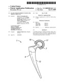 PLASMA SPRAYED POROUS COATING FOR MEDICAL IMPLANTS diagram and image