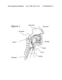 Method And Device For The Treatment Of Obstructive Sleep Apnea And Snoring diagram and image