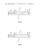 Method to Cement a Perforated Casing diagram and image