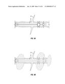 Method to Cement a Perforated Casing diagram and image