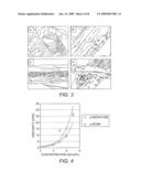 AMBIENT STORED BLOOD PLASMA EXPANDERS diagram and image