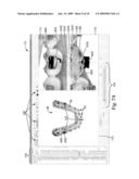 DIGITAL ORTHODONTIC APPLIANCE COUPLING MATRIX diagram and image