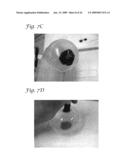 SYSTEMS AND METHODS FOR DETECTING ABNORMAL CELLS diagram and image