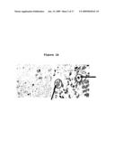 Use of phosphatases to treat tumors overexpressing N-CoR diagram and image