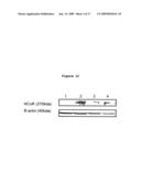 Use of phosphatases to treat tumors overexpressing N-CoR diagram and image