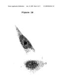 Use of phosphatases to treat tumors overexpressing N-CoR diagram and image