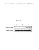 Use of phosphatases to treat tumors overexpressing N-CoR diagram and image