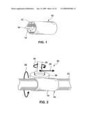 Seeding Implantable Medical Devices with Cells diagram and image