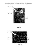 Seeding Implantable Medical Devices with Cells diagram and image