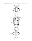 Seeding Implantable Medical Devices with Cells diagram and image