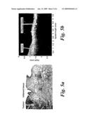 OPTICAL COHERENCE TOMOGRAPHY diagram and image