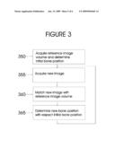 ULTRASONIC BONE MOTION TRACKING SYSTEM diagram and image