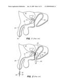 TRANSRECTAL ULTRASOUND ABLATION PROBE diagram and image