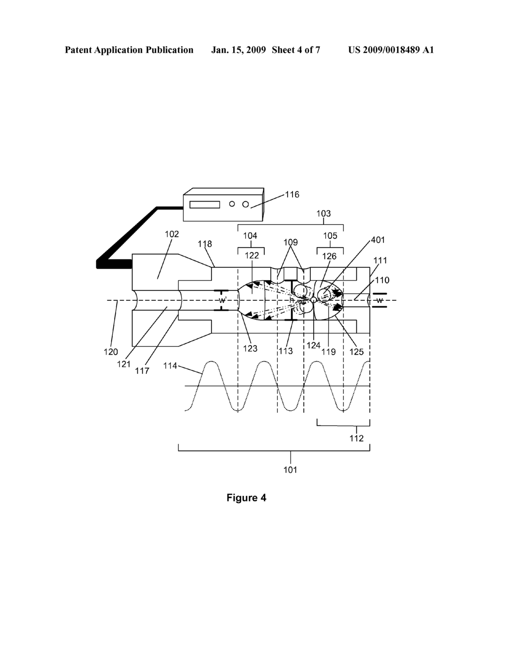 METHOD OF TREATING WOUNDS BY CREATING A THERAPEUTIC COMBINATION WITH ULTRASONIC WAVES - diagram, schematic, and image 05